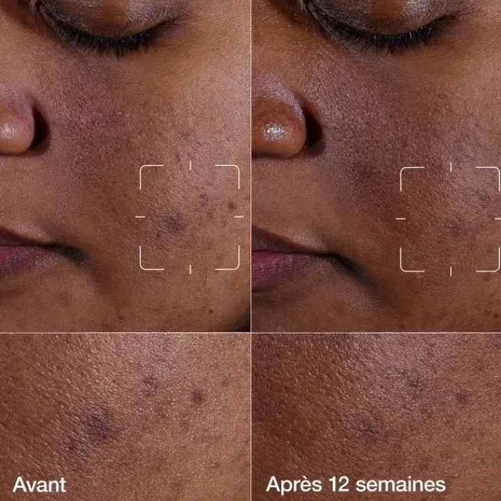 CLINIQUE Even Better Clinical™ Sérum Illuminateur Anti-taches