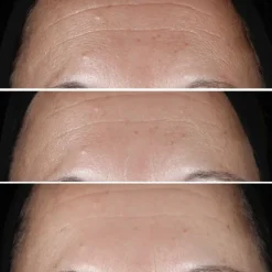 CLINIQUE Smart Clinical Repair Sérum Correcteur Anti-Rides