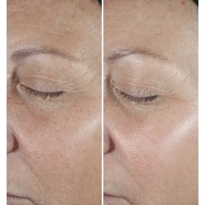 CLINIQUE Smart Clinical Repair Sérum Correcteur Anti-Rides