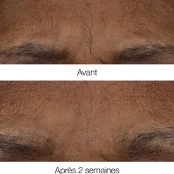 CLINIQUE Smart Clinical Repair™                Baume Rétinoïde Anti-Rides