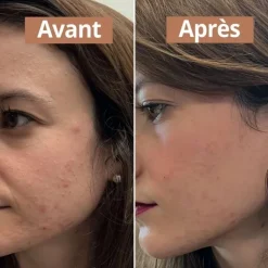 Comme Avant Sérum Anti-Imperfections                Soin Visage