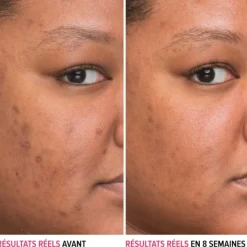 It Cosmetics Bye Bye Dark Spots                Sérum Anti-taches à la Niacinamide