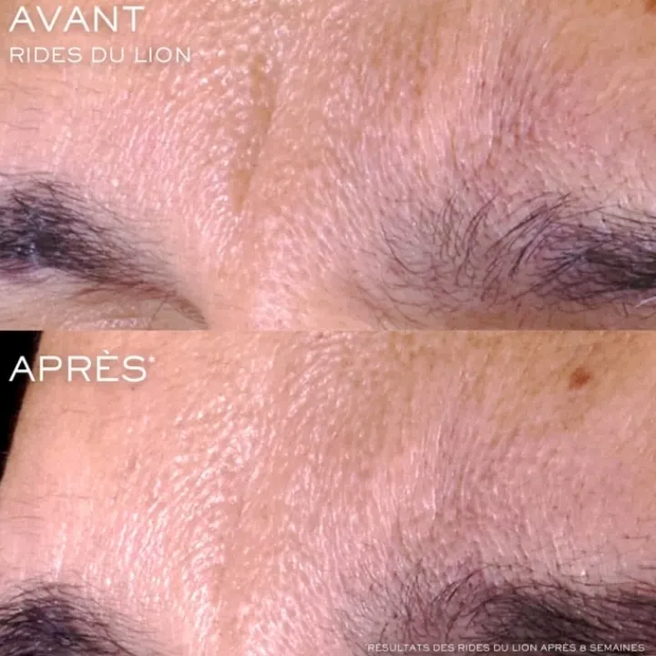 LANCÔME Rénergie C.R.x. Triple Sérum Rétinol Sérum Visage