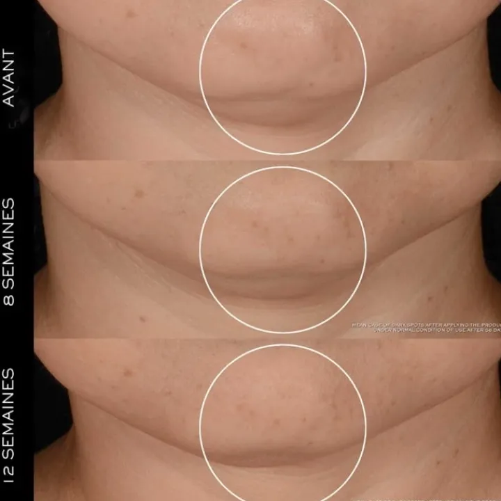 LANCÔME Rénergie H.P.N. 300-Peptide Crème Anti-Âge Haute-Performance - Recharge